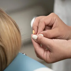 Neuro Acupuncture treatment